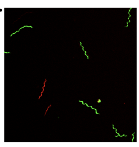 Effect of Levels of Acetate on the Mevalonate Pathway of <i>Borrelia burgdorferi</i>