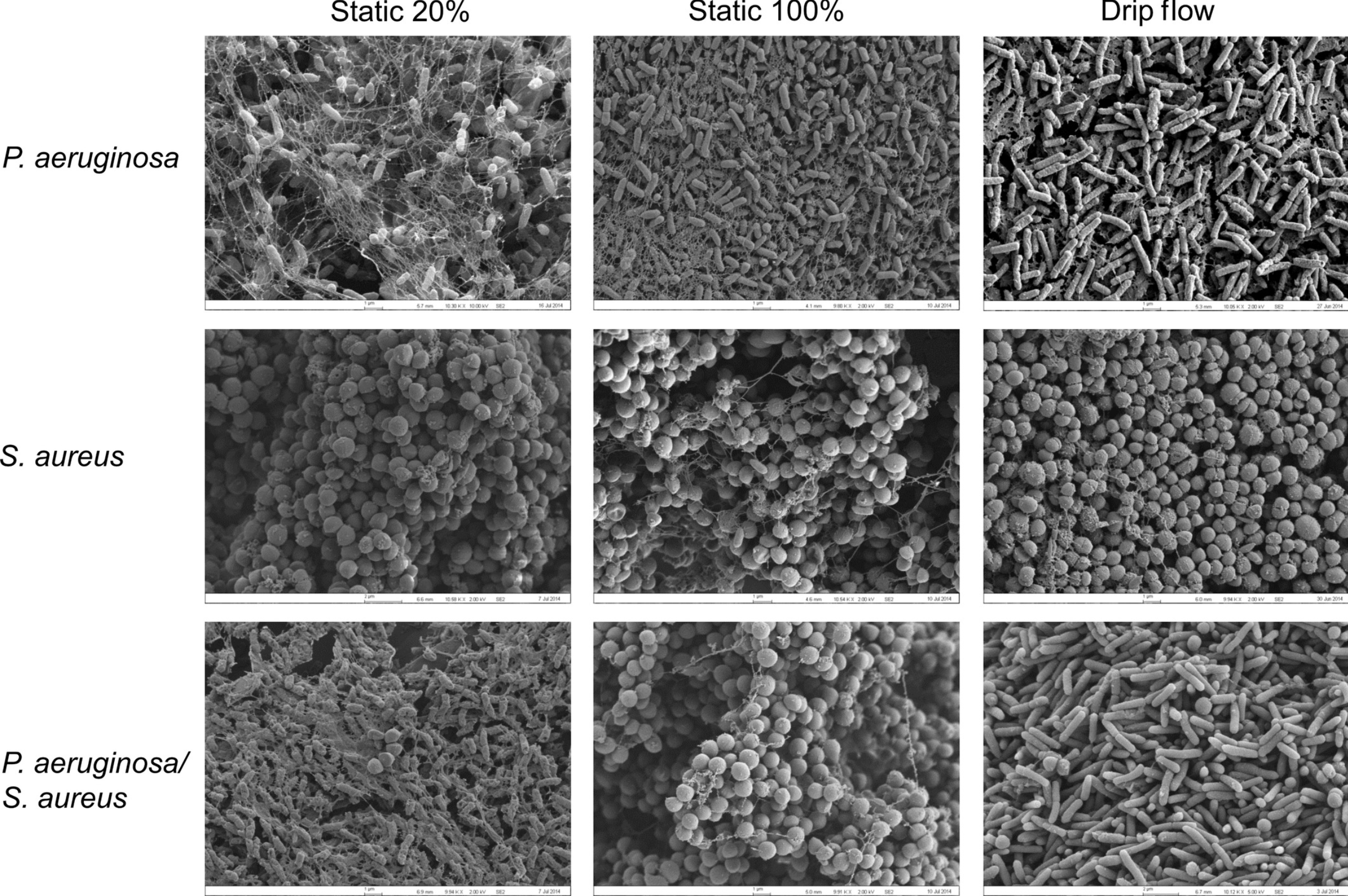 Global transcriptome responses including small RNAs during mixed‐species interactions with methicillin‐resistant <i>Staphylococcus aureus</i> and <i>Pseudomonas aeruginosa</i>